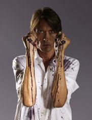 Brett Anderson