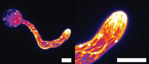 Mikroskopische Aufnahmen des Zellskeletts von Phytophthora während des Eindringens in einen Wirt zeigen die sich selbst schärfende Struktur. Foto: Wageningen University & Research